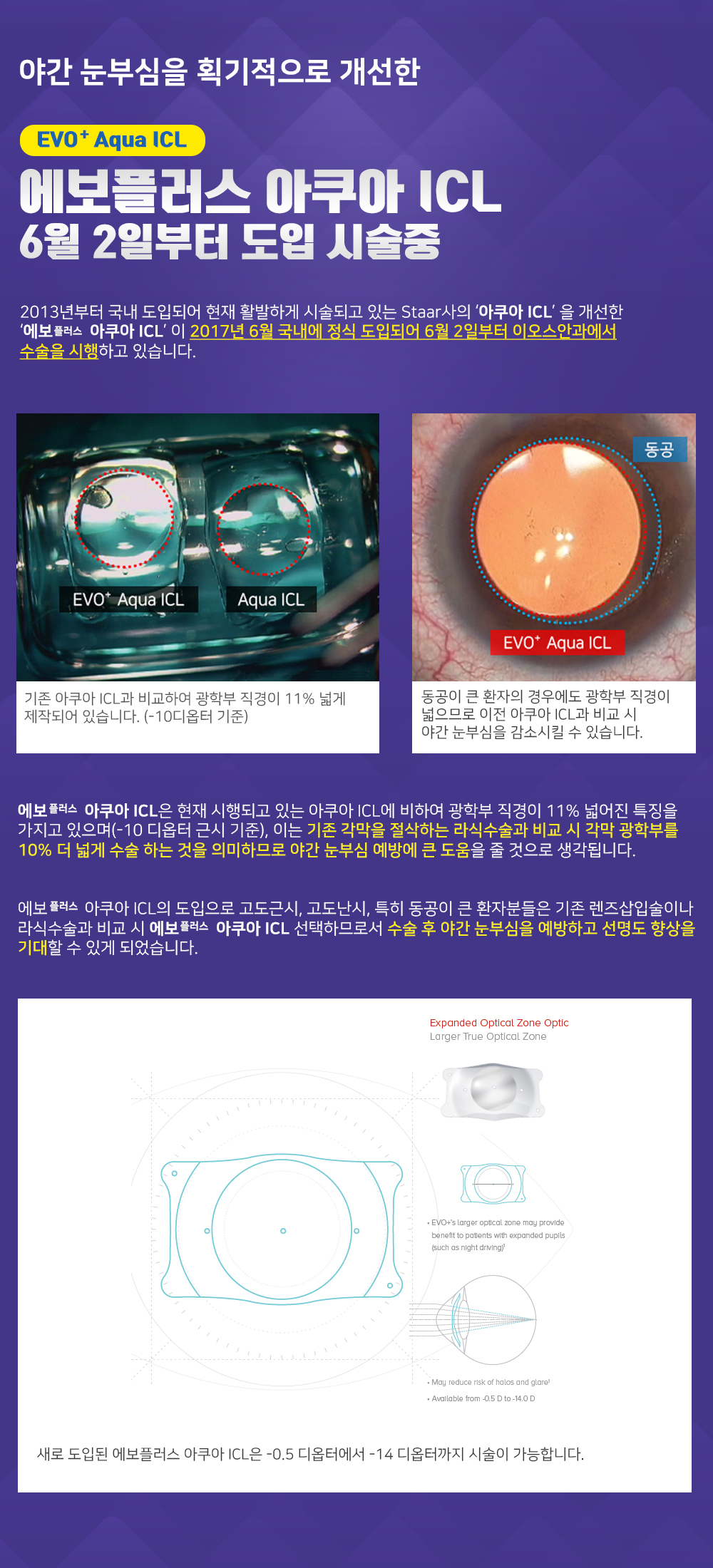 20170610소식_에보플러스 도입 시술중.jpg